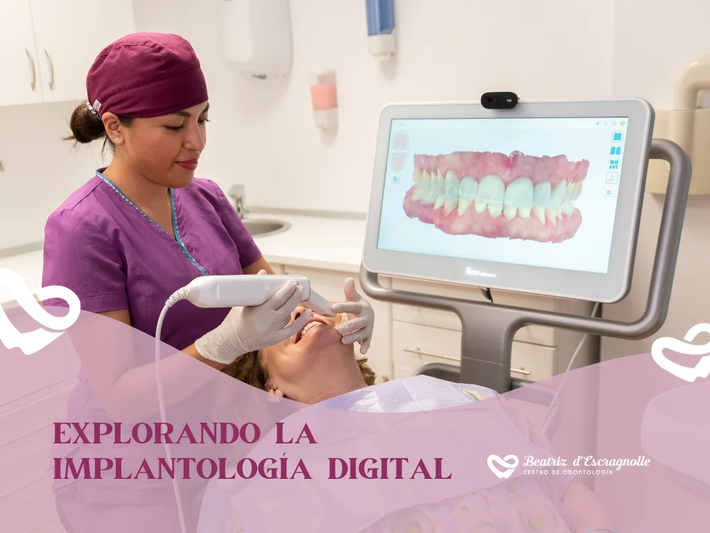 Explorando la Implantología Digital