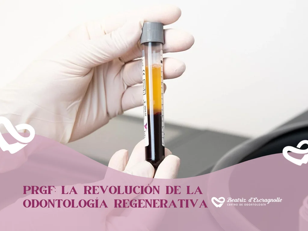 PRGF: la revolución de la odontología regenerativa